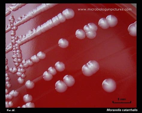 Moraxella catarrhalis colonies on blood agar. Colony morphology of M ...