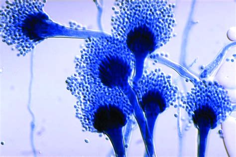 One Health: Fungal Pathogens of Humans, Animals, and Plants - NCBI ...