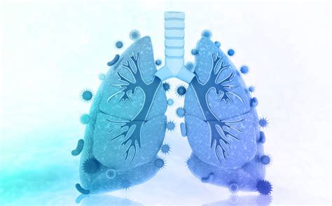 Understanding the Major Factors and Trends Driving the ARDS Prevalence