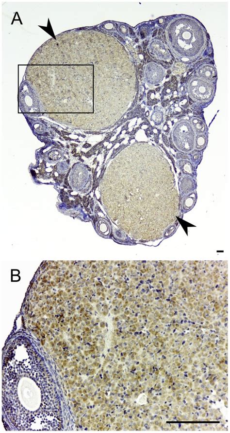 Immunohistochemical Localization Of TSPO In An Ovary From A 14 5 Day