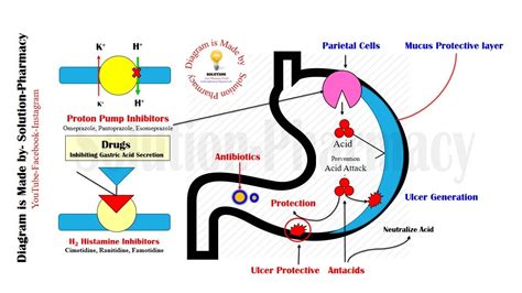 Peptic Ulcer Disease Pathophysiology