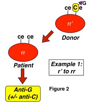 G Wiz Decoding The G Antigen And Anti G Blood Bank Guy