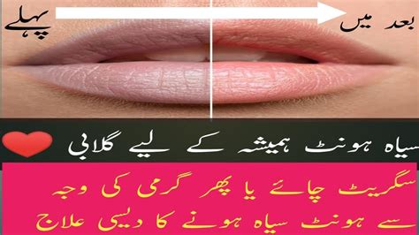 How To Make Lips Pink Naturally Hont Pink Krne Ka Tarika Kalay Hont