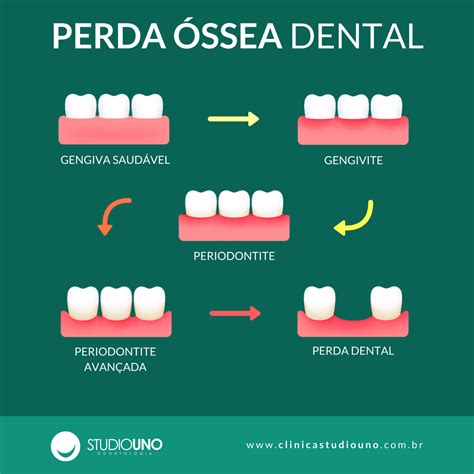 Periodontia Studiouno Odontologia