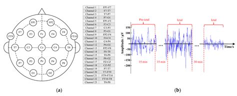 Brain Sciences Free Full Text Automatic Seizure Detection And