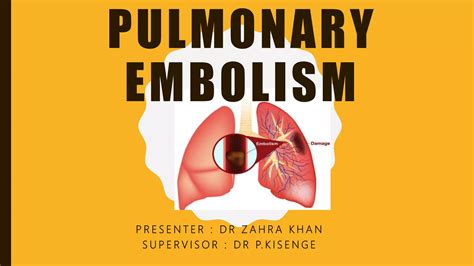 Pulmonary Embolism Ppt