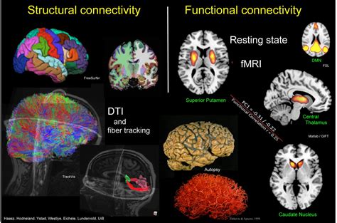 On Consciousness Resting State FMRI And Neurodynamics Nonlinear