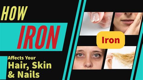 How Iron Affects Your Hair Skin And Nails Dermatologist Explain Youtube