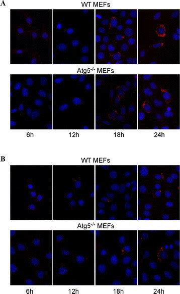 Fluorescence Microscopy Analysis Of Wt Mefs And Atg Mefs Infected