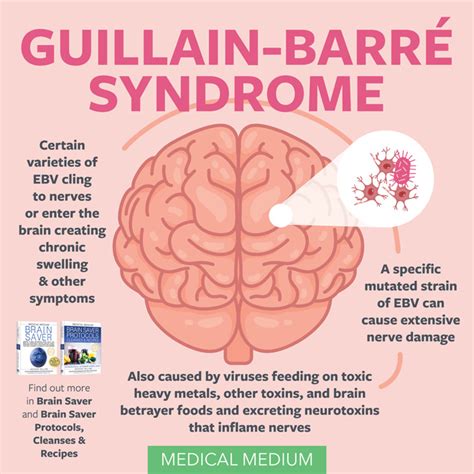 Guillain Barr Syndrome