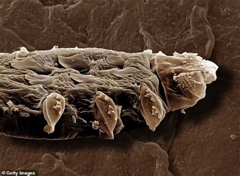 Meet The Creepy Crawlies That Have Sex On Your Face While You Sleep