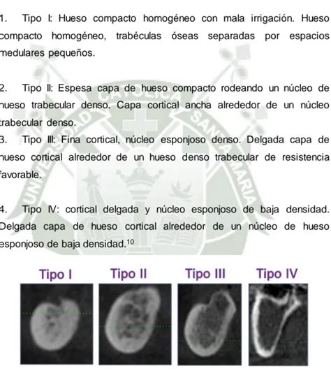 Clasificaci N De Las Atrofias Del Reborde Residual