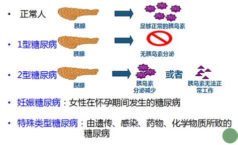 糖尿系列教育之认识糖尿病 知乎