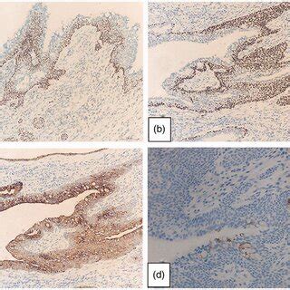 Representative Photomicrographs From Immunohistochemistry Of The