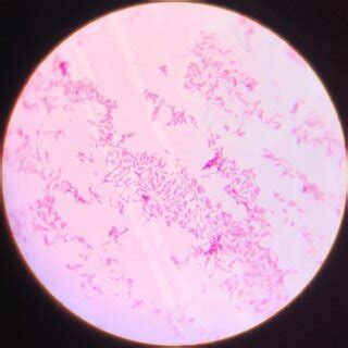 Gram staining -Gram Negative Rods. | Download Scientific Diagram