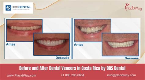 10 Best Dentists In Costa Rica For 2025