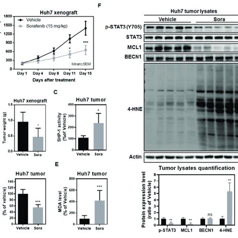 BECN1 Silencing Relieves Sorafenib Triggered Ferroptosis In HCC Cells