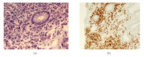 A Histopathology Of Biopsies Taken From Gastric Lesions Showing Download Scientific Diagram