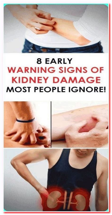 8 Warning Symptoms of Kidney Damage | Kidney damage, Healthy facts ...