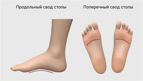 Плоскостопие у взрослых и детей - что это, виды, степени, лечение