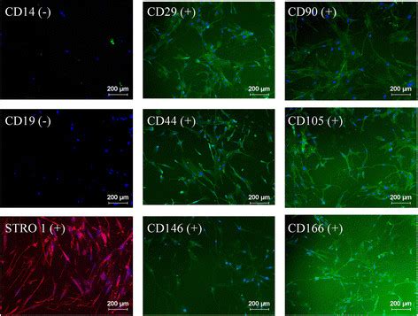 Surface markers. Illustrative micrographs of human mesenchymal stem ...