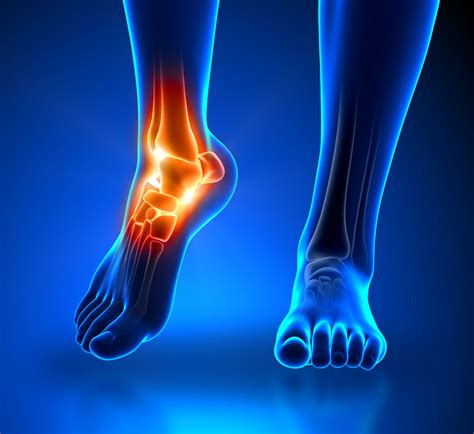 Are Nerve Problems Causing Your Foot Pain?