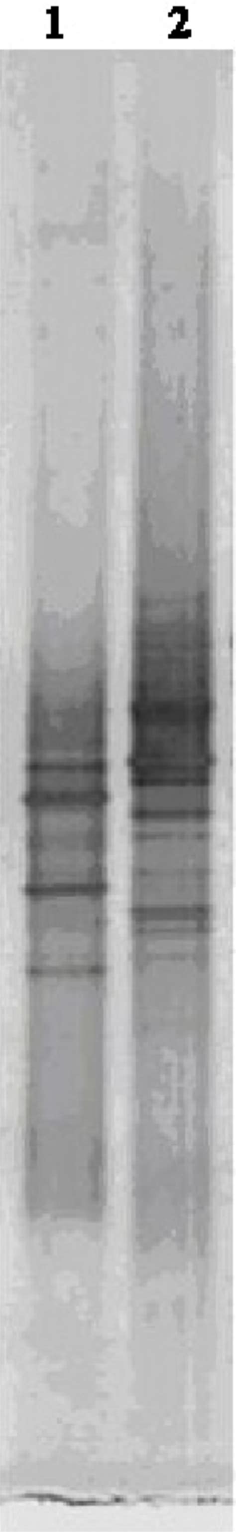 Denaturing Gradient Gel Electrophoresis Analyses Of 16s Rdna Fragments Download Scientific