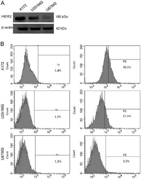 Expression Of Her2 In Glioblastoma Multiforme Gbm Cell Lines Detected