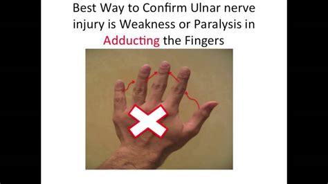 Ulnar Nerve Impingement