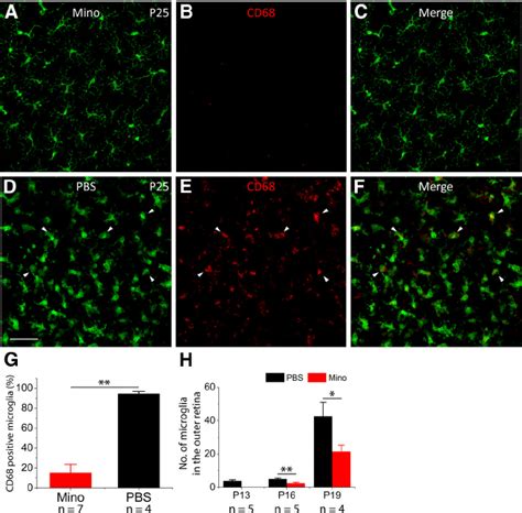 Minocycline Treatment Reduces Microglia Activation And Infiltration In