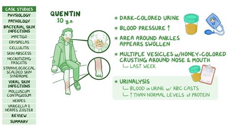 Bacterial And Viral Skin Infections Pathology Review Osmosis Hot Sex