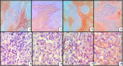 Immunohistochemical Staining With Bcl 2 A And B In E Group C And