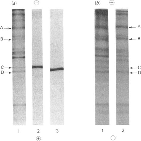 Analysis By Sdspolyacrylamide Gel Electrophoresis And Autoradiography Download Scientific