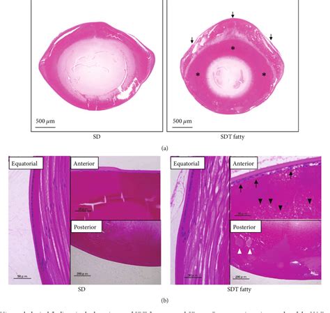 Figure 3 from Diabetic Cataract in Spontaneously Diabetic Torii Fatty Rats | Semantic Scholar