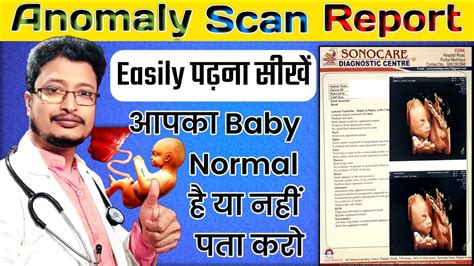 How To Check Anomaly Scan Report At Simona Auzenne Blog