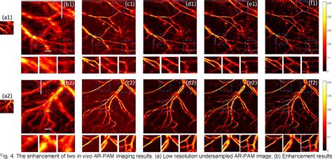 Hsd Pam High Speed Super Resolution Deep Penetration Photoacoustic