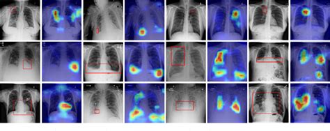 Figure 11 From Multi Level Residual Feature Fusion Network For Thoracic