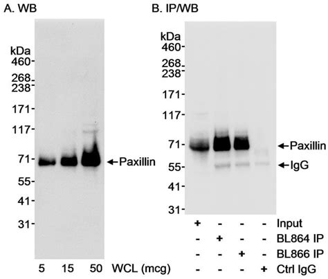 Paxillin Rabbit anti-Human, Polyclonal, Bethyl Laboratories 100 μL ... 
