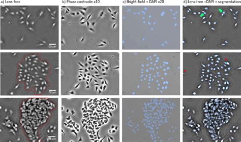 A Reconstructed Phase Image Of A Fixed Cell Culture Of Hela Cells For