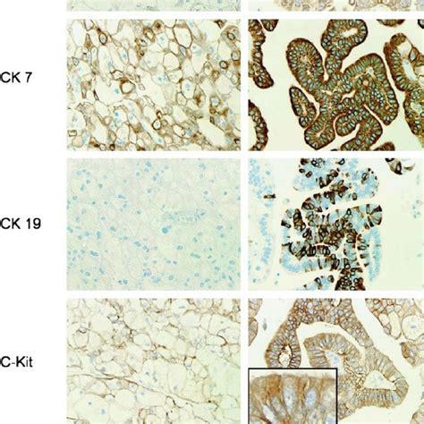 Comparative Immunohistochemical Analysis Of The Chromophobe And