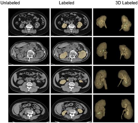 Diagnostics Free Full Text Deep Segmentation Networks For