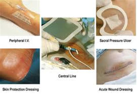 Integ PT Week 8 Ish Wound Dressings Flashcards Quizlet