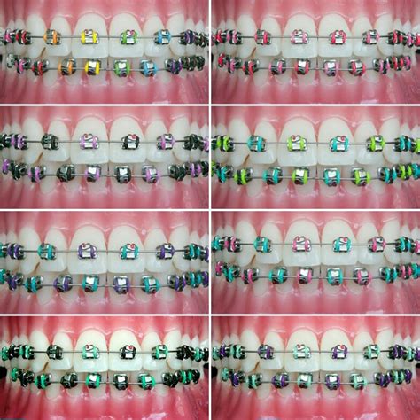 Braces band colors wheel - jlpase