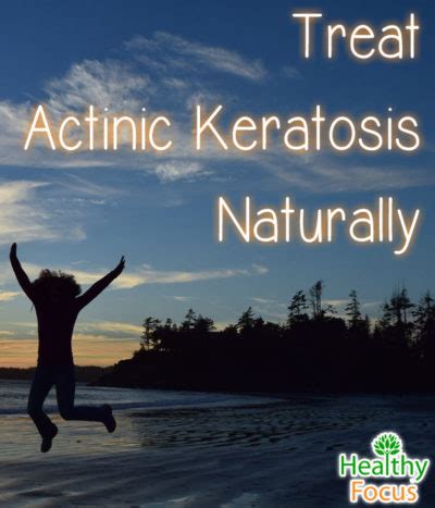 9 Tested Actinic Keratosis Natural Treatments - Healthy Focus