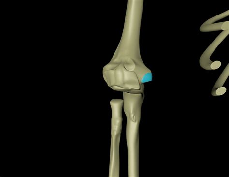 Flexor carpi ulnaris – Myoreflex