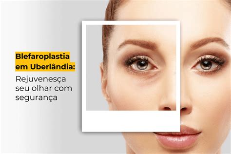 Blefaroplastia Em Uberlândia Rejuvenesça Seu Olhar Com Segurança