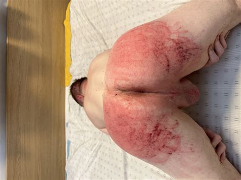 My Ass Being Whipped By My Master Pics Xhamster