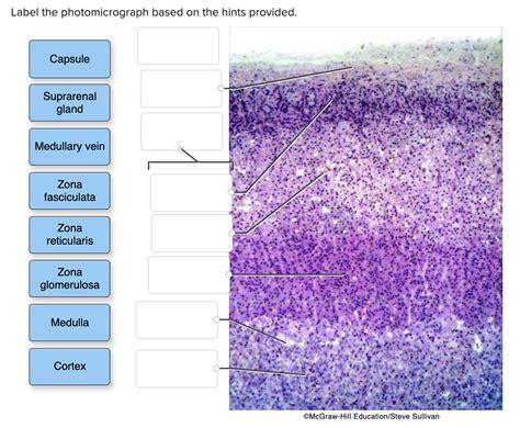 Solved Label The Photomicrograph Based On The Hints Chegg