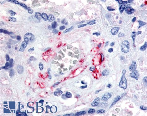 Ihc Plus Flt Vegfr Polyclonal Antibody Rabbit Anti Human Lsbio