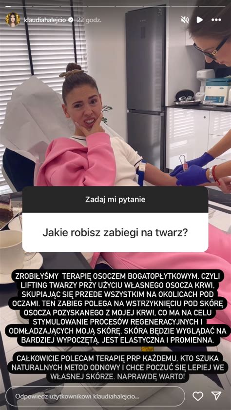 Czy Klaudia Halejcio Robi A Botoks Postawi A Spraw Jasno Rmf Fm